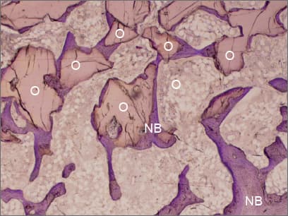 Histologie — 3 Monate nach Implantation